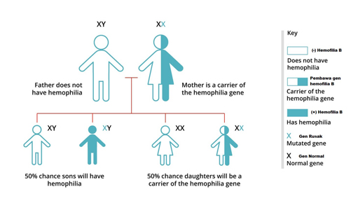 Genetika Hemofilia B