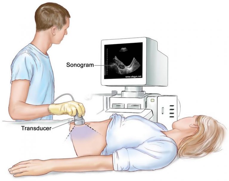 Ultrasonografi Usg Jenis Prosedur Dan Resikonya Idn Medis 5823