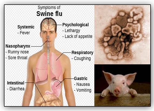 Berikut ini yang merupakan gejala penyakit influenza adalah