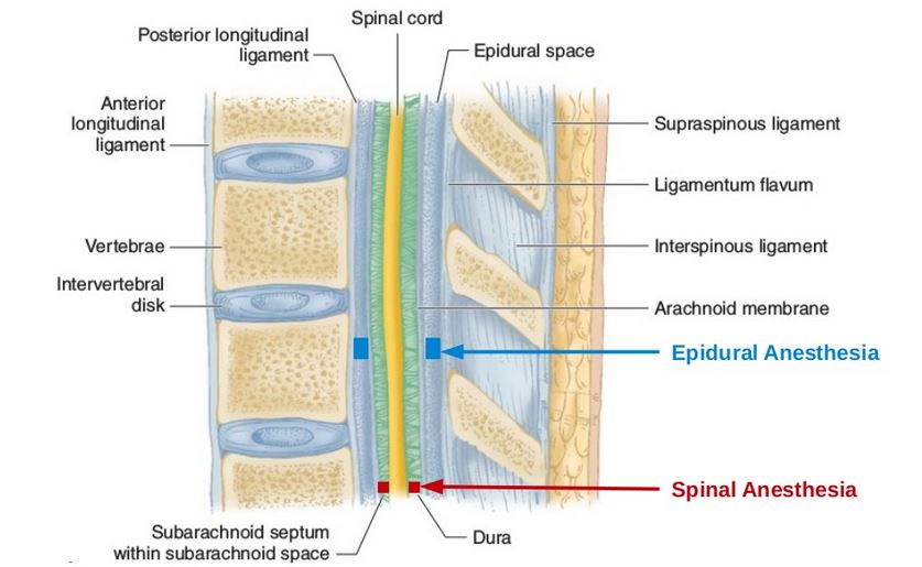 perbedaan anestesi spinal dan epidural
