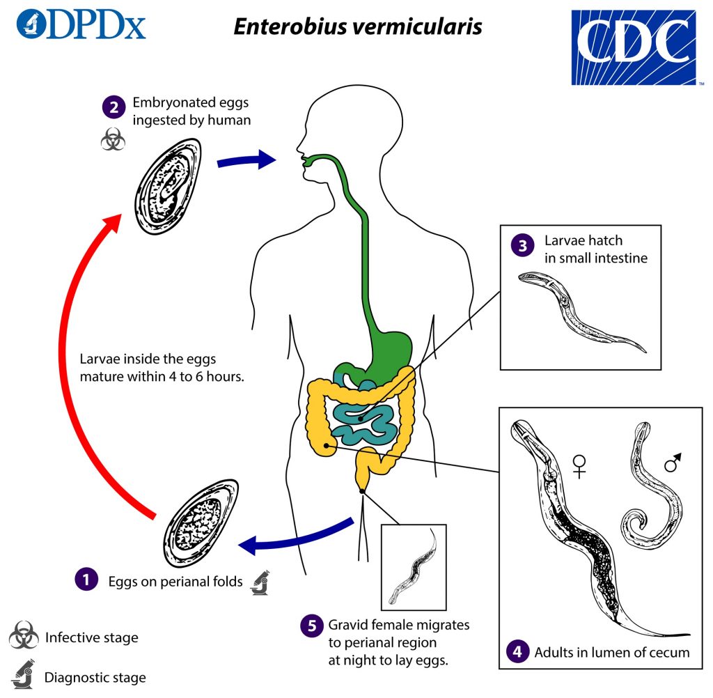 az enterobiasis diagnosztizálására módszerekkel