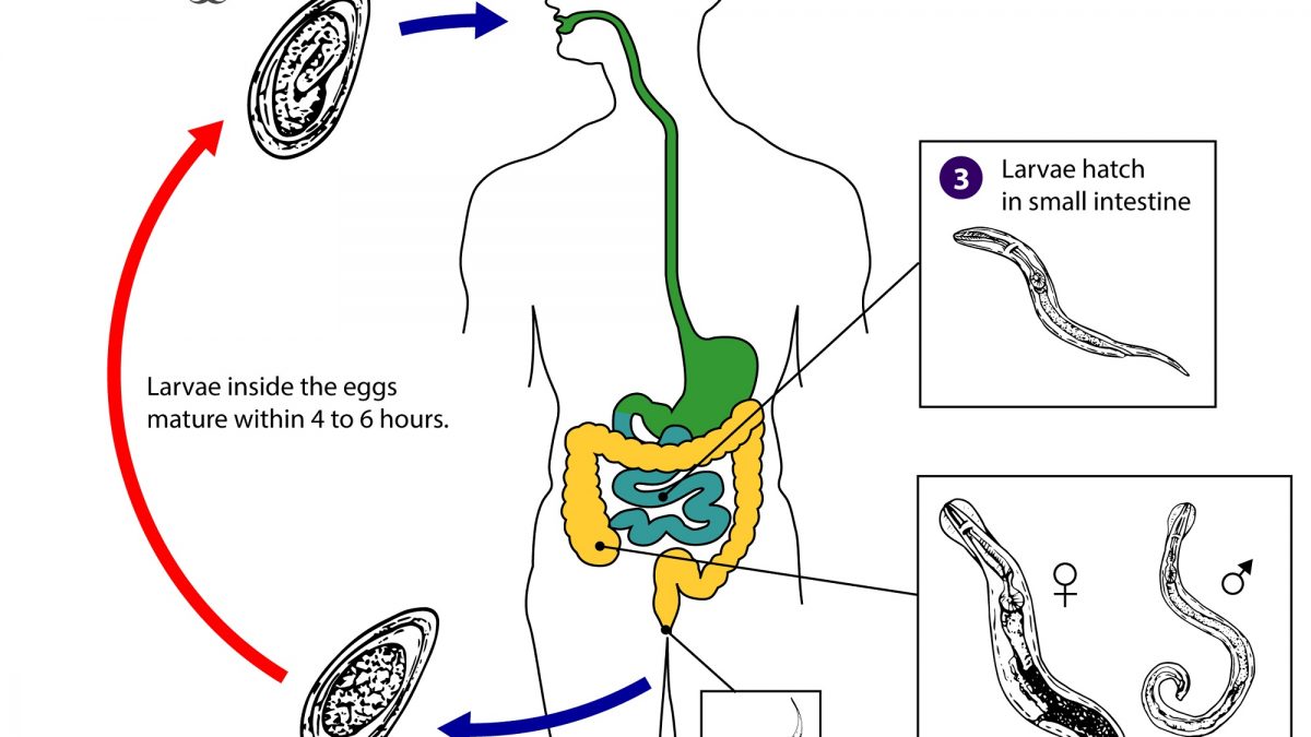 Enterobiosis gyermekeknél tünetek és kezelés, nap alatt a bél körül