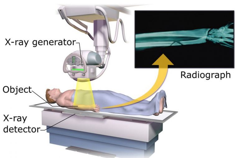 digital-radiography