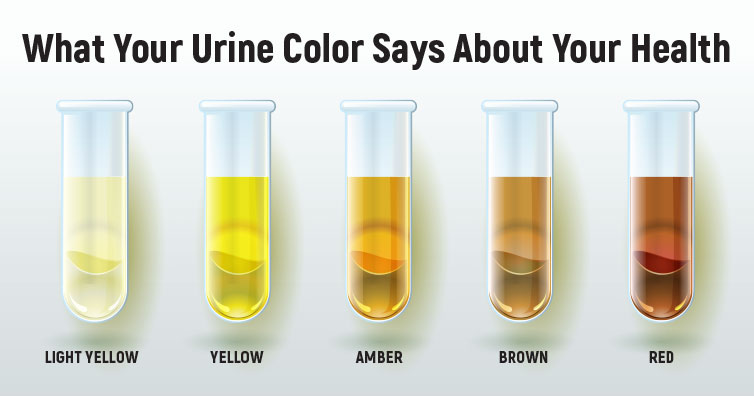 chart warna urine